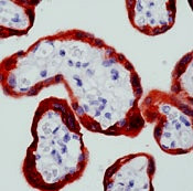 c-Abl Antibody in Immunohistochemistry (Paraffin) (IHC (P))