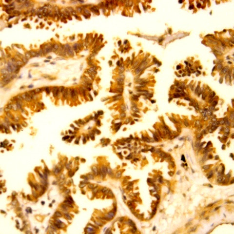 E2F5 Antibody in Immunohistochemistry (Paraffin) (IHC (P))