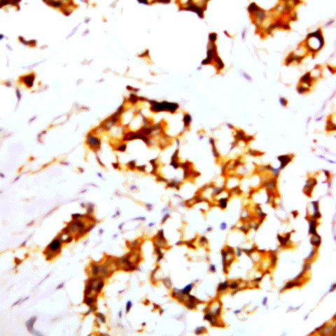 TNF alpha Antibody in Immunohistochemistry (Paraffin) (IHC (P))