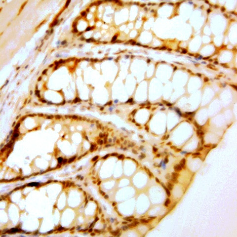 Phospho-Rho Kinase/ROCKII (Thr396) Antibody in Immunohistochemistry (Paraffin) (IHC (P))