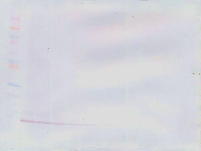 CCL5 (RANTES) Antibody in Western Blot (WB)