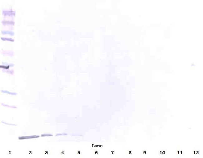 beta-Defensin 1 Antibody in Western Blot (WB)