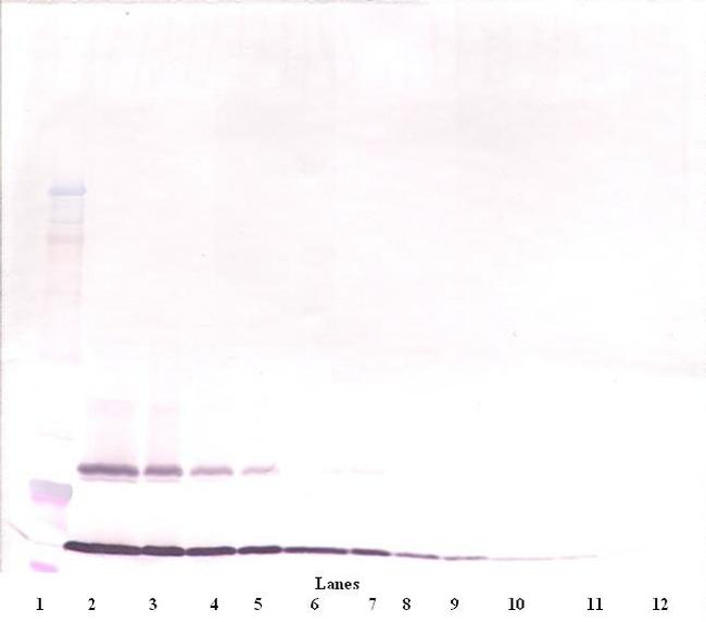 TSLP Antibody in Western Blot (WB)