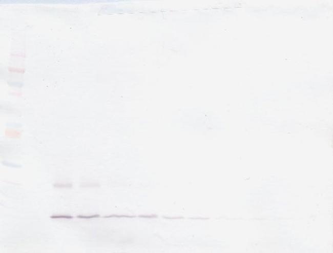 PTHLH Antibody in Western Blot (WB)