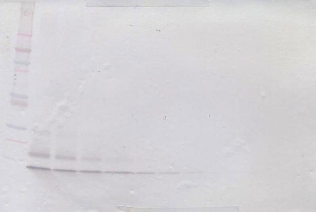 MIP-3 beta Antibody in Western Blot (WB)