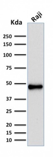 PAX5/BSAP (Early B-Cell Marker) Antibody in Western Blot (WB)