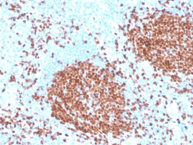 PAX5/BSAP (Early B-Cell Marker) Antibody in Immunohistochemistry (Paraffin) (IHC (P))