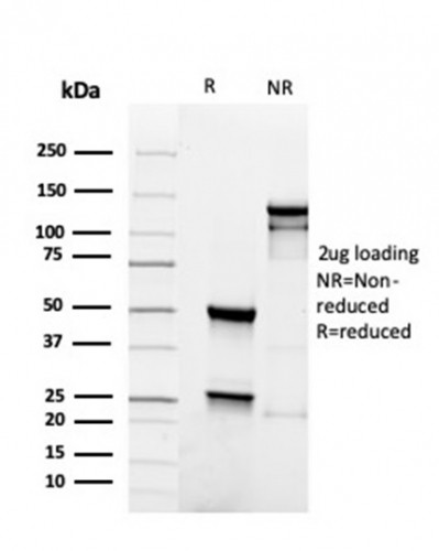 PAX5/BSAP (Early B-Cell Marker) Antibody in SDS-PAGE (SDS-PAGE)