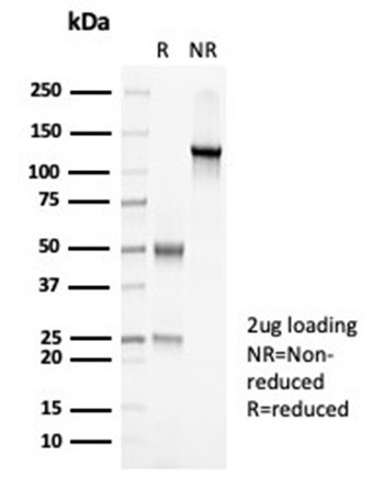 PAX7 (Rhabdomyosarcoma Marker) Antibody in SDS-PAGE (SDS-PAGE)