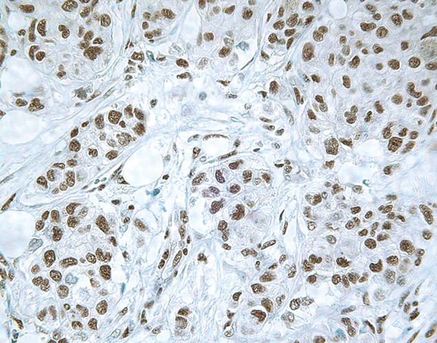 SMAD3 Antibody in Immunohistochemistry (IHC)