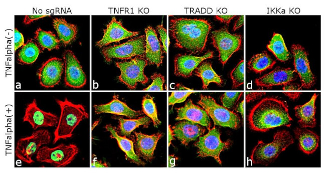 NFkB p65 Antibody in Immunocytochemistry (ICC/IF)