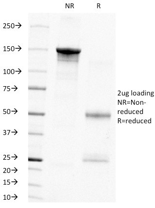 PCNA (Proliferating Cell Nuclear Antigen) (G1- and S-phase Marker) Antibody in SDS-PAGE (SDS-PAGE)