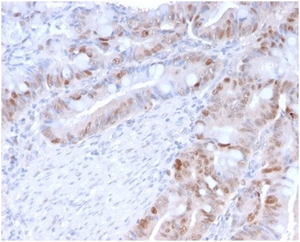PCNA (Proliferating Cell Nuclear Antigen) (G1- and S-phase Marker) Antibody in Immunohistochemistry (Paraffin) (IHC (P))