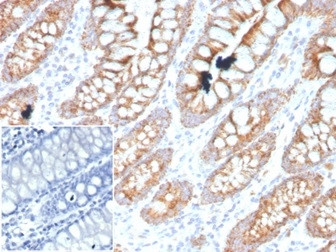 PDGF beta (PDGFB) Antibody in Immunohistochemistry (Paraffin) (IHC (P))