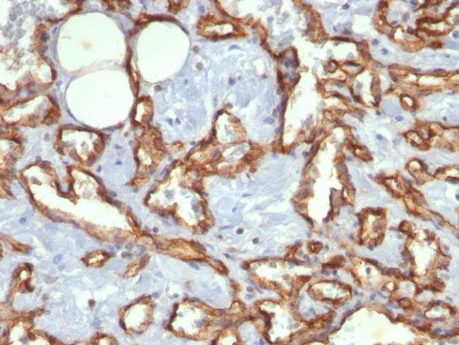 CD31/PECAM-1 (Endothelial Cell Marker) Antibody in Immunohistochemistry (Paraffin) (IHC (P))