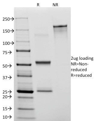 CD31/PECAM-1 (Endothelial Cell Marker) Antibody in SDS-PAGE (SDS-PAGE)
