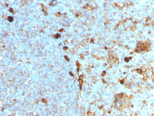 Alpha-1-Antitrypsin (SERPINA1) Antibody in Immunohistochemistry (Paraffin) (IHC (P))