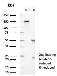 Alpha-1-Antitrypsin (SERPINA1) (Hepatocellular and Histiocytic Marker) Antibody in SDS-PAGE (SDS-PAGE)