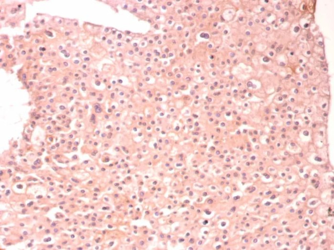 Alpha-1-Antitrypsin (SERPINA1) (Hepatocellular and Histiocytic Marker) Antibody in Immunohistochemistry (Paraffin) (IHC (P))