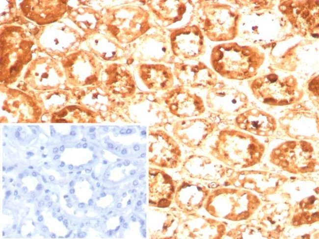 Alpha-1-Antitrypsin (SERPINA1) (Hepatocellular and Histiocytic Marker) Antibody in Immunohistochemistry (Paraffin) (IHC (P))