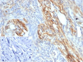 PIK3R2/Phosphoinositide-3-kinase regulatory subunit 2 Antibody in Immunohistochemistry (Paraffin) (IHC (P))