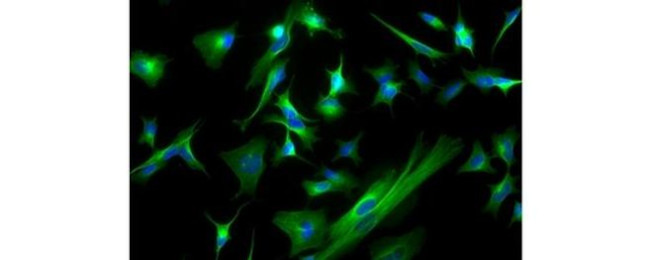 beta-3 Tubulin Antibody in Immunocytochemistry (ICC/IF)