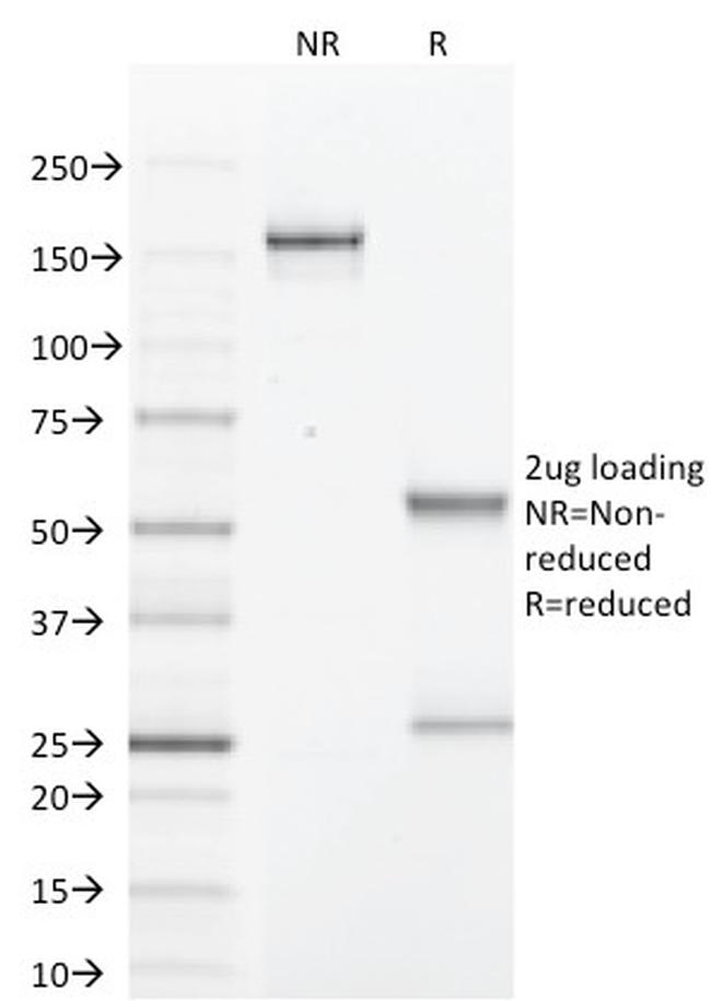 GCDFP-15 Antibody in SDS-PAGE (SDS-PAGE)