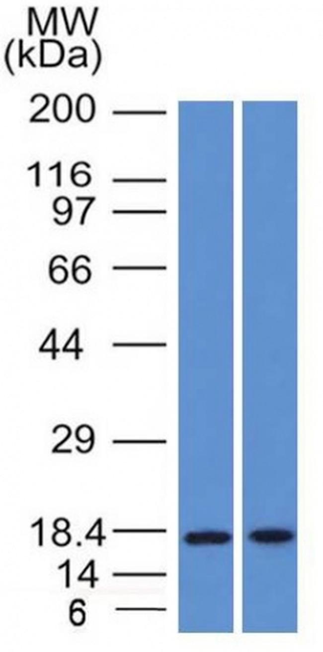 GCDFP-15 Antibody in Western Blot (WB)