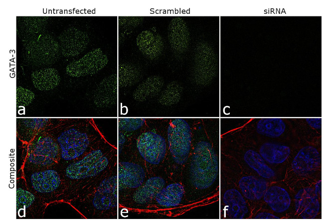 Gata-3 Antibody in Immunocytochemistry (ICC/IF)