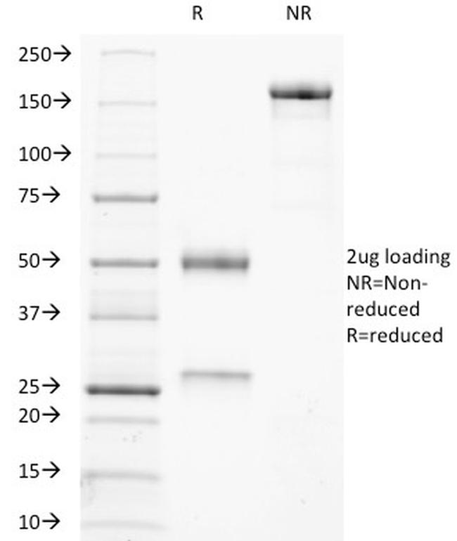 TRAcP (Tartrate-Resistant Acid Phosphatase) Antibody in SDS-PAGE (SDS-PAGE)