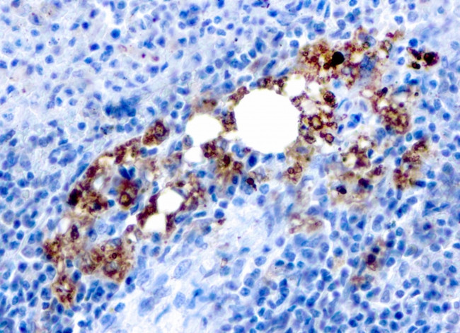 TRAcP (Tartrate-Resistant Acid Phosphatase) Antibody in Immunohistochemistry (Paraffin) (IHC (P))