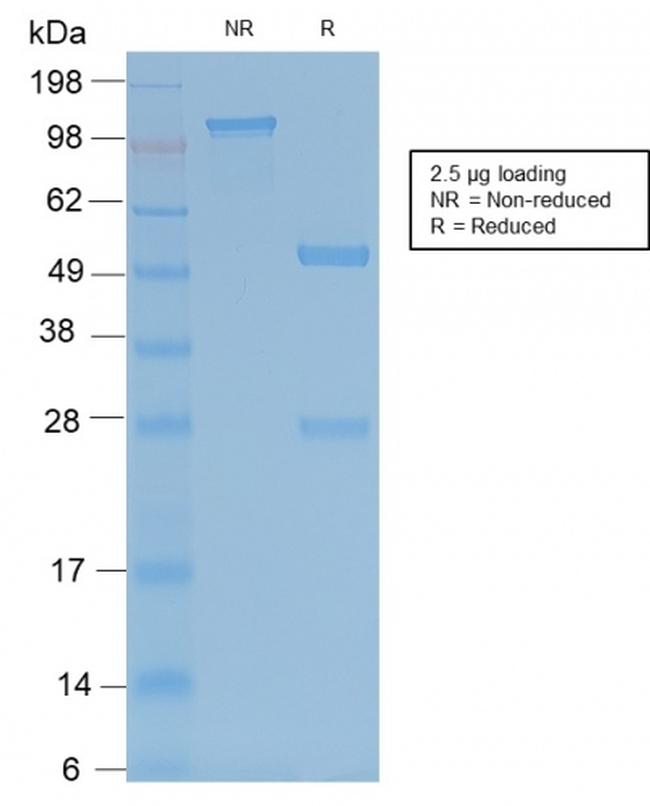 TRAcP (Tartrate-Resistant Acid Phosphatase) Antibody in SDS-PAGE (SDS-PAGE)