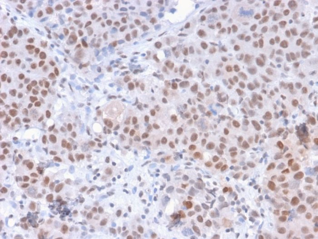 Phospho-RNA pol II CTD (Ser5) Antibody in Immunohistochemistry (Paraffin) (IHC (P))