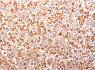 ACTH (Adrenocorticotrophic Hormone) (Pituitary Marker) Antibody in Immunohistochemistry (Paraffin) (IHC (P))