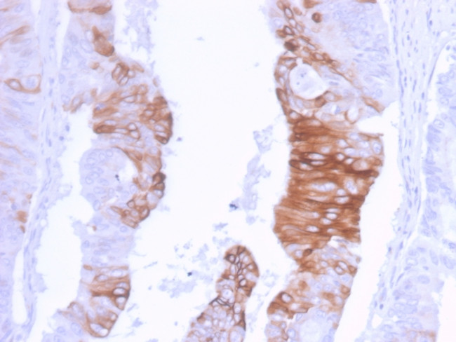 Cytokeratin 20 (KRT20) Antibody in Immunohistochemistry (Paraffin) (IHC (P))