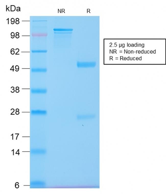 Cytokeratin 20 (KRT20) Antibody in SDS-PAGE (SDS-PAGE)