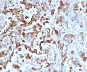 Cytokeratin 20 (KRT20) (Colorectal Epithelial Marker) Antibody in Immunohistochemistry (Paraffin) (IHC (P))