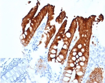 Cytokeratin 20 (KRT20) (Colorectal Epithelial Marker) Antibody in Immunohistochemistry (Paraffin) (IHC (P))