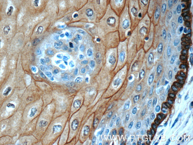 Annexin A1 Antibody in Immunohistochemistry (Paraffin) (IHC (P))