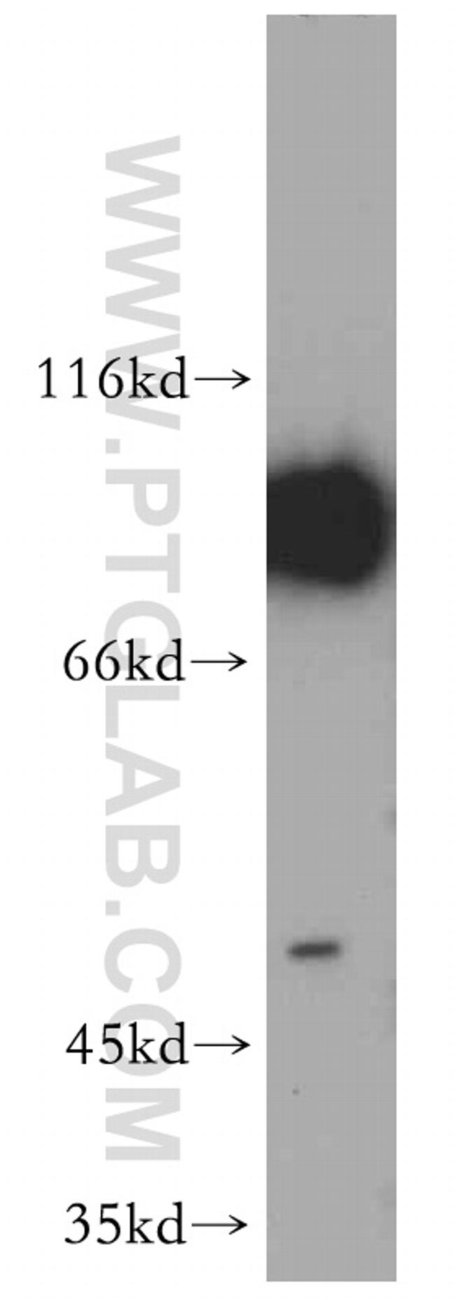 NBS1 Antibody in Western Blot (WB)