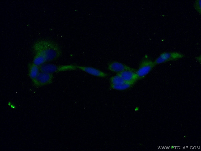 PPP3CB Antibody in Immunocytochemistry (ICC/IF)