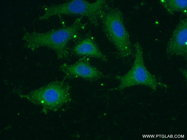 GNAT1 Antibody in Immunocytochemistry (ICC/IF)