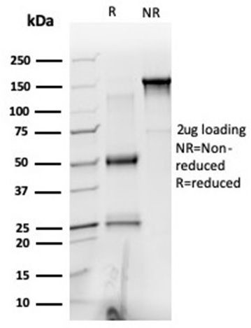 PRMT6 Antibody in SDS-PAGE (SDS-PAGE)