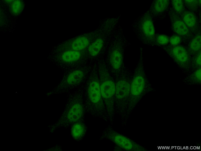 CPSF7 Antibody in Immunocytochemistry (ICC/IF)