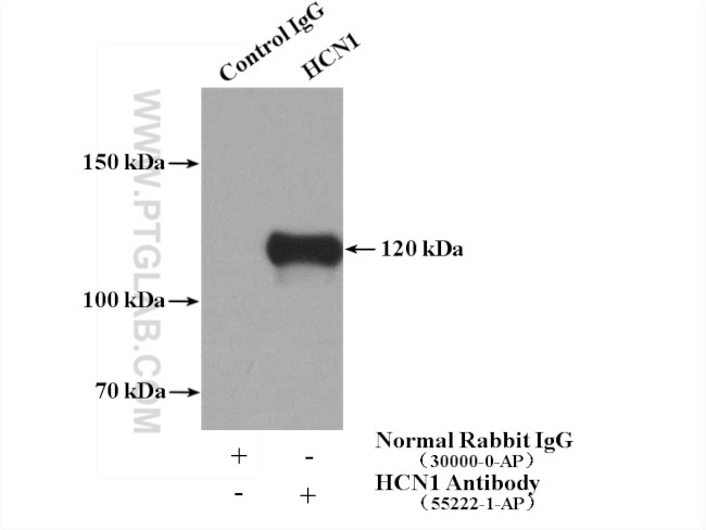 HCN1 Antibody in Immunoprecipitation (IP)