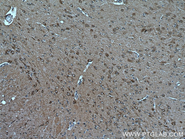 VGLUT1 Antibody in Immunohistochemistry (Paraffin) (IHC (P))