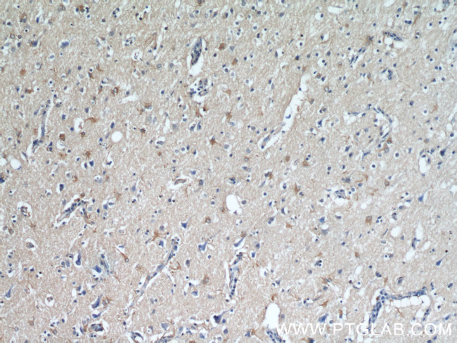 VGLUT1 Antibody in Immunohistochemistry (Paraffin) (IHC (P))