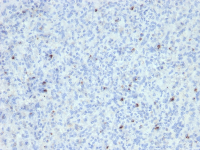 Perforin (Pore Forming Protein) (Apoptosis Marker) Antibody in Immunohistochemistry (Paraffin) (IHC (P))