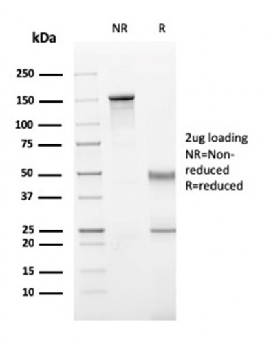 Perforin-1 (Pore Forming Protein) (Apoptosis Marker) Antibody in SDS-PAGE (SDS-PAGE)