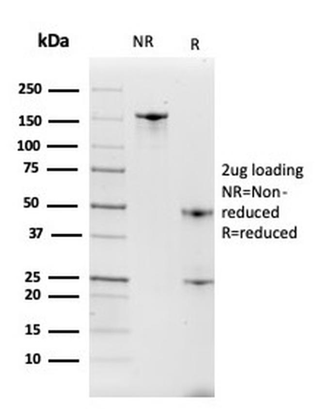 Intelectin 1/Omentin Antibody in SDS-PAGE (SDS-PAGE)